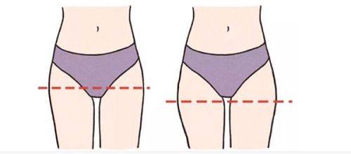 四、求美者如何用刘亦菲眼型精细传达医美需求