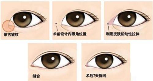 成都致臻爱医疗美容门诊部医生名单及擅长领域：