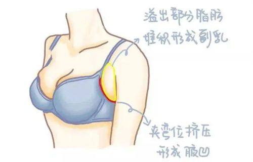 五、眼袋改善的美学与安心提示