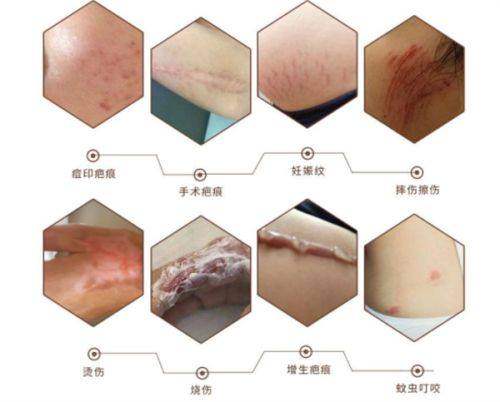 成都致臻爱医疗美容门诊部价格表：