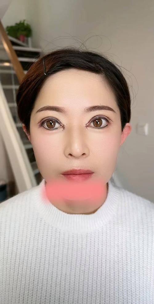 嘉兴华 山门诊整形美容中 心医生名单及擅长领域: