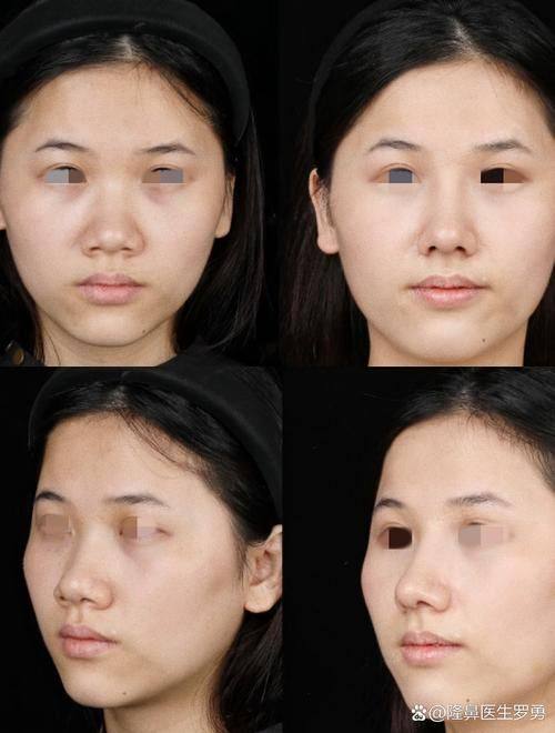 三亚杨智明医疗美容诊所怎么样?