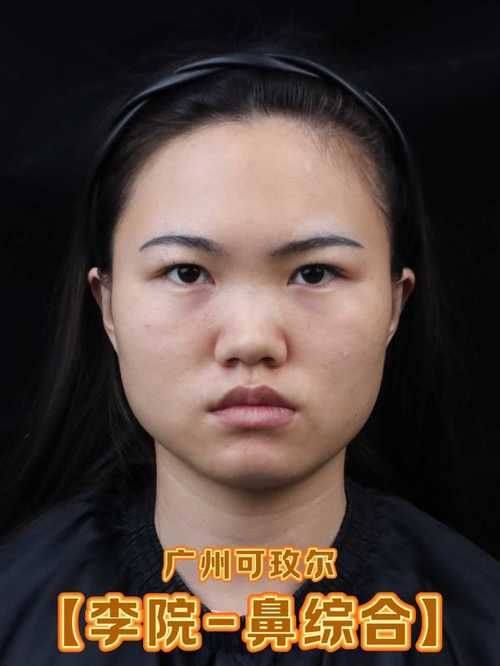 广州茗悦整形医院价格表：