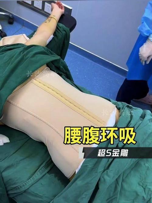 自贡市非常好人民医院整形外科价格表：