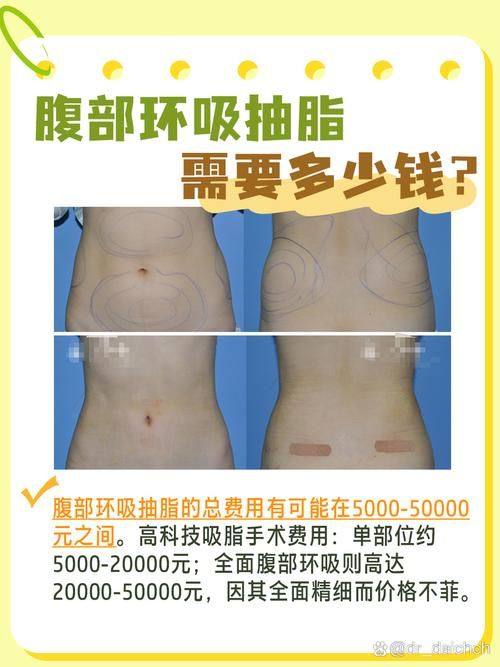 自贡市非常好人民医院整形外科预约挂号方式：