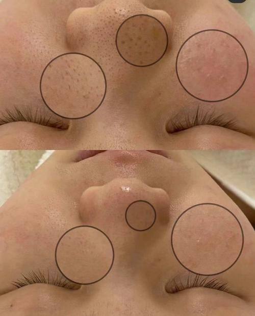 韩国medicalo医院口碑评价：