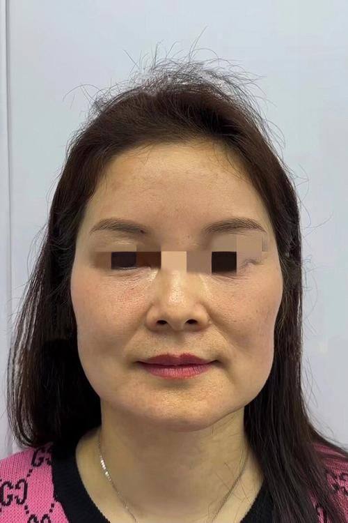 韩国medicalo医院怎么样？