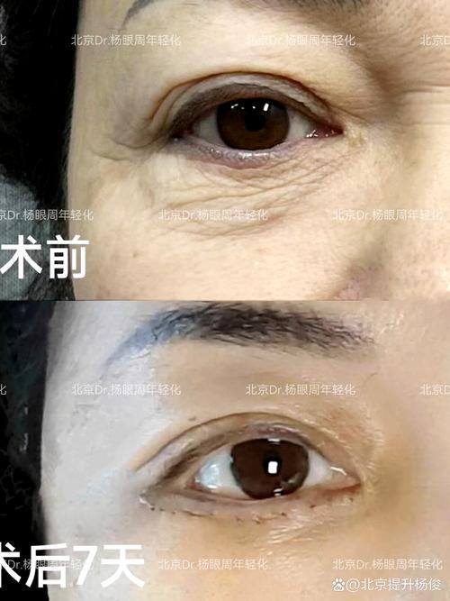 北京斯嘉丽医疗美容医院怎么样？