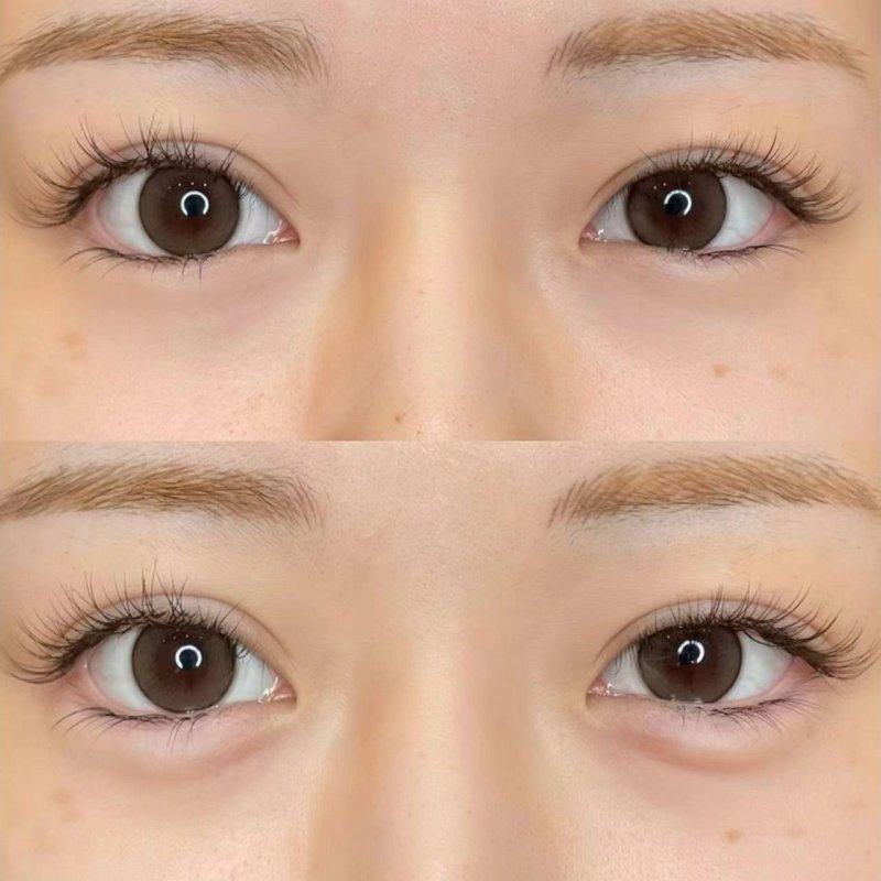 三、多位医美医生将刘亦菲眼型列为设计参考