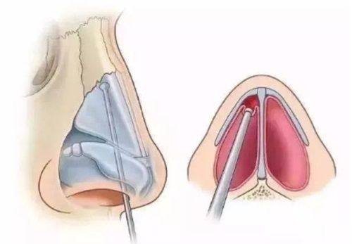 余干县容貌社整形医院擅长项目：