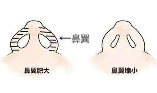 五、不同年龄阶段眼袋的典型表现