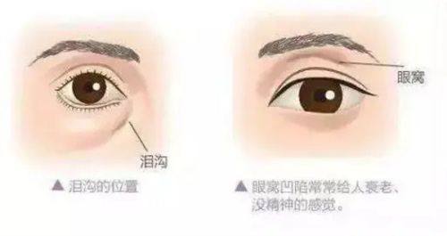 五、居家快速护理小贴士：更快修复不留痕的核心要点