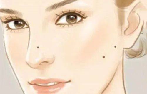 六、祛眼袋技术哪种更好：选择核心原则