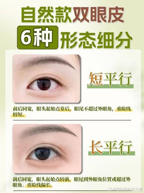 mijak整形外科擅长项目：