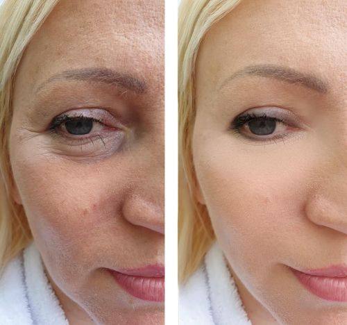 曹燕医生技术优势