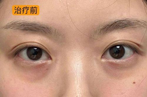 重庆造美坊整形美容门诊部价格表：