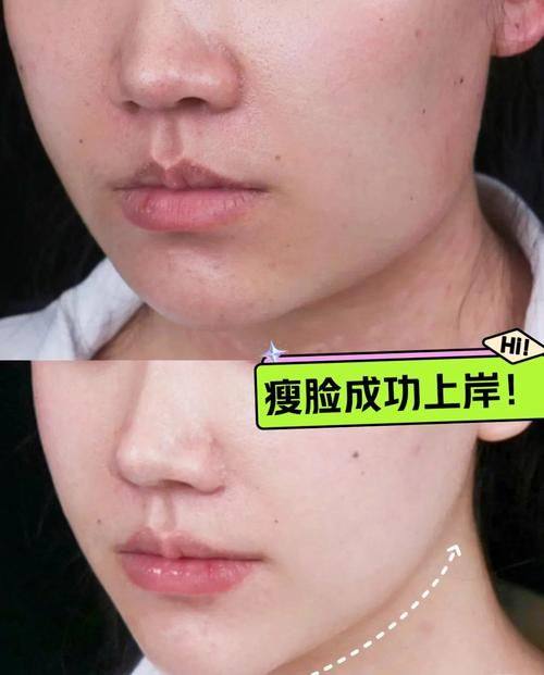 曹燕医生擅长领域