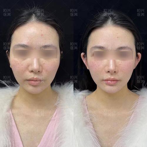 陈双爽医生技术优势