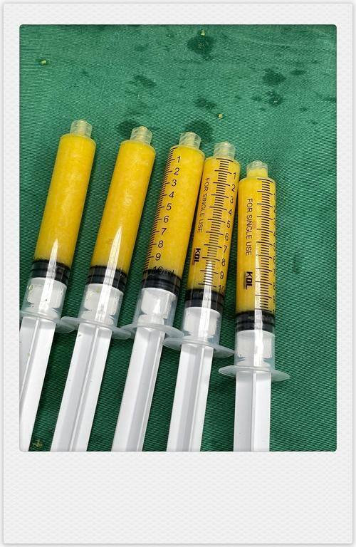 佛山健凯整形医院擅长项目：