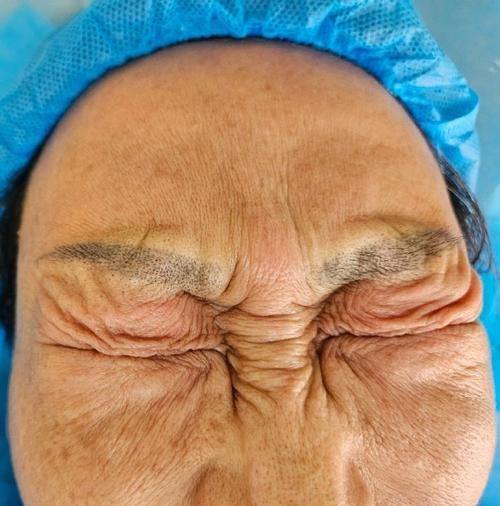 佛山健凯整形医院价格表：