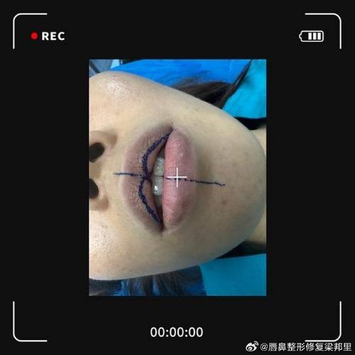 成都中科美美医疗美容门诊部擅长项目