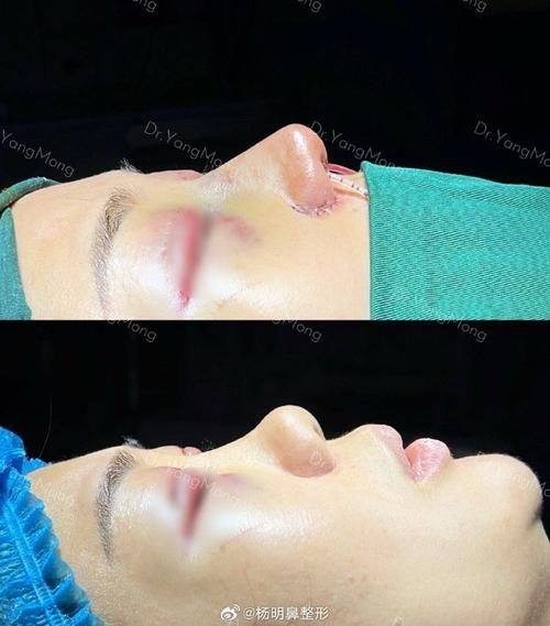 南昌美帝颜医疗美容门诊部价格表：