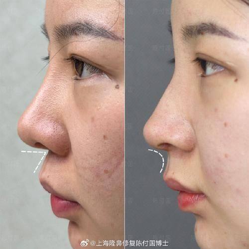 佛山健凯整形医院怎么样？