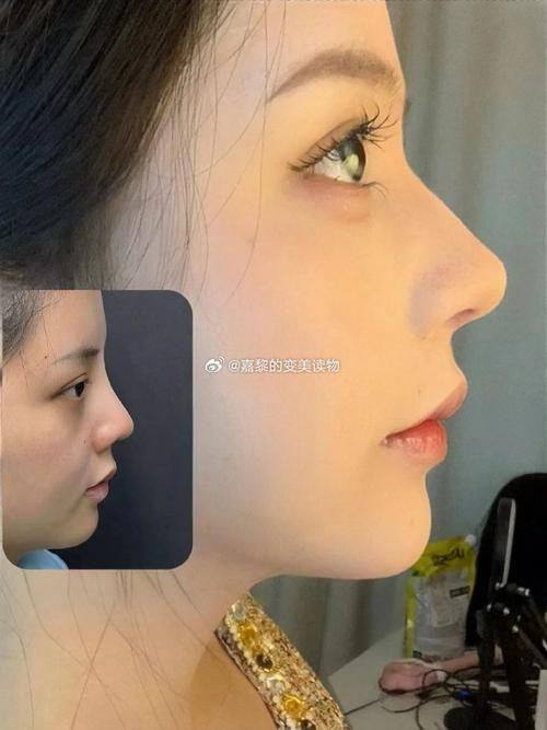 佛山健凯整形医院口碑评价：