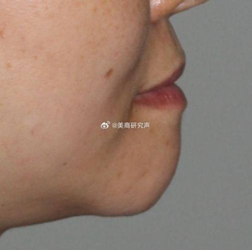 重庆造美坊整形美容门诊部擅长项目：