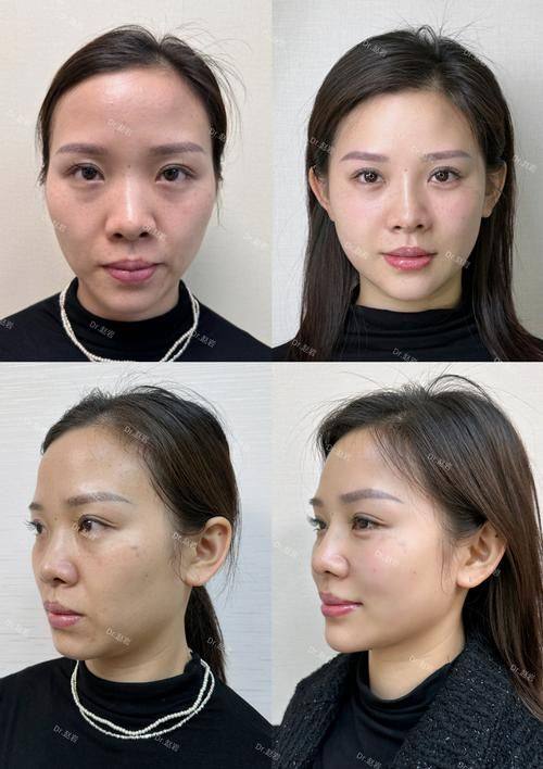 曹燕医生口碑评价