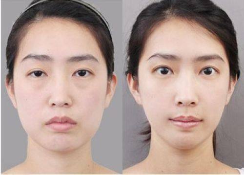 王军敏医生技术优势