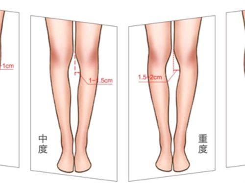四、术后疤痕护理的适用时机与周期