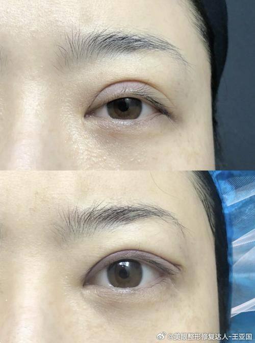 深圳诺德雅医学美容门诊部怎么样？