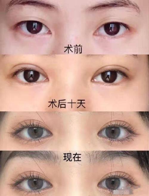 绵阳妙典整形医院医生名单及擅长领域：