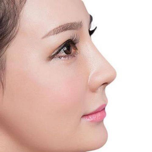 本我整形外科怎么样？