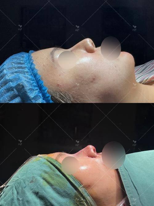 本我整形外科口碑评价：