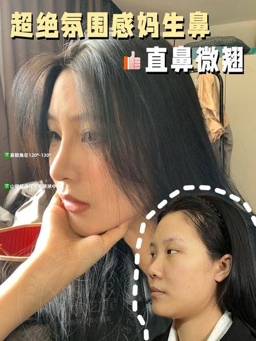 深圳圣雅门诊部价格表：