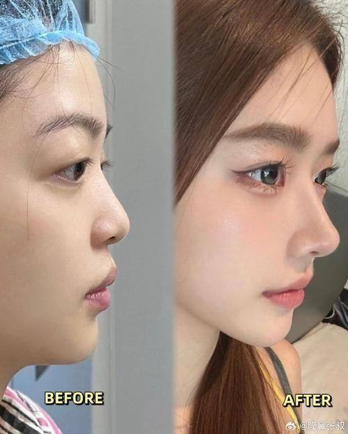 刘西富医生技术优势