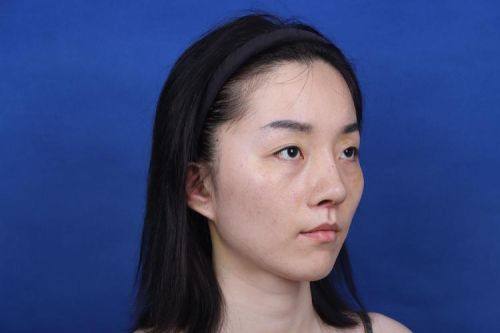 宁波鄞州美塑整形医院怎么样？