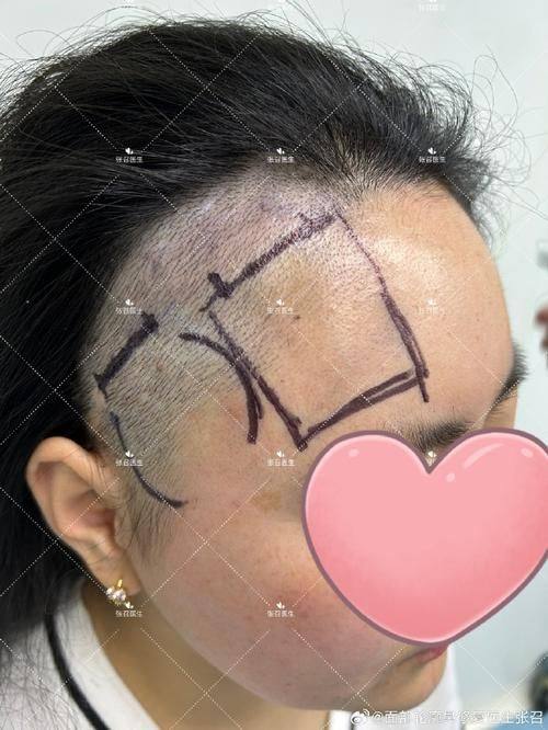 绵阳妙典整形医院擅长项目：