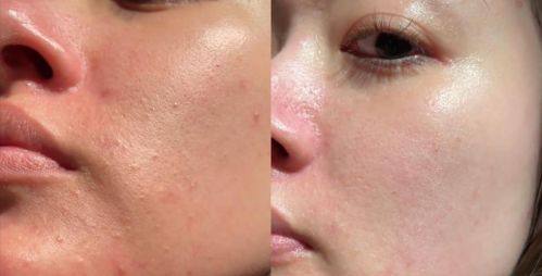 内蒙古紫洁医疗美容医院医生名单及擅长领域：