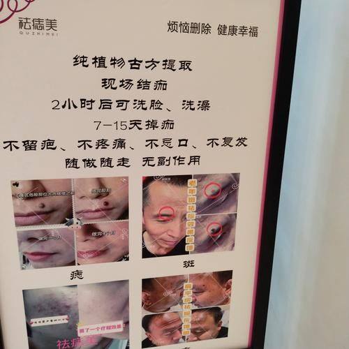 河北儿童医院整形外科擅长项目：