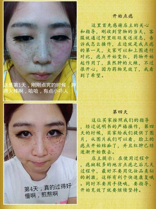 河北儿童医院整形外科口碑评价：