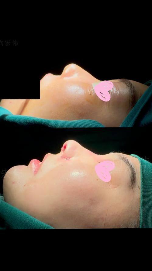 宁波鄞州美塑整形医院价格表：