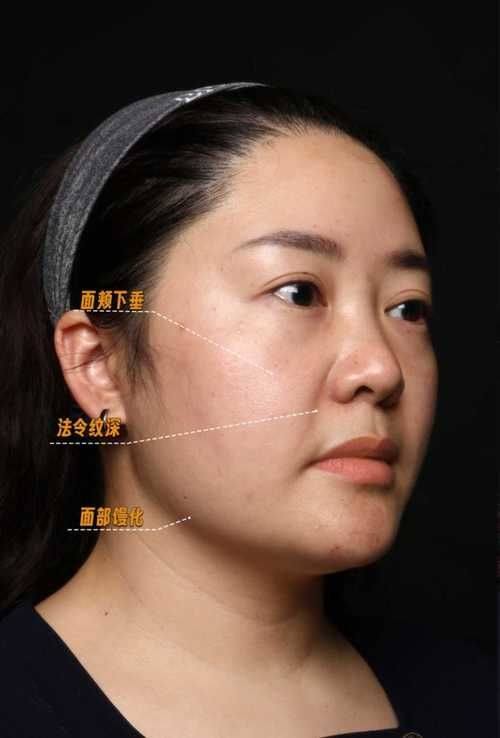 本我整形外科价格表：