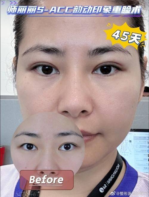 河北儿童医院整形外科预约挂号方式：