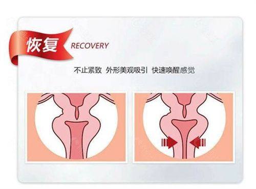 五、孩子眼袋大怎么调理