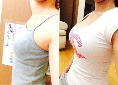 莆田市永秀医疗美容门诊价格表：