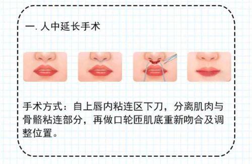 上海丽质整形医院价格表：