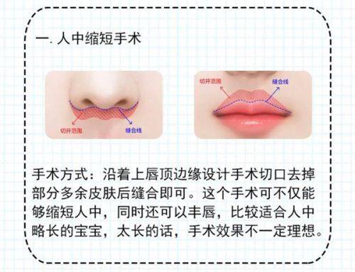 上海丽质整形医院口碑评价：